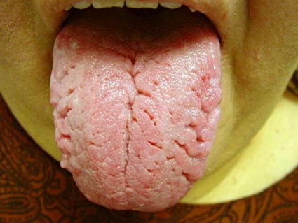 lengua cerebro